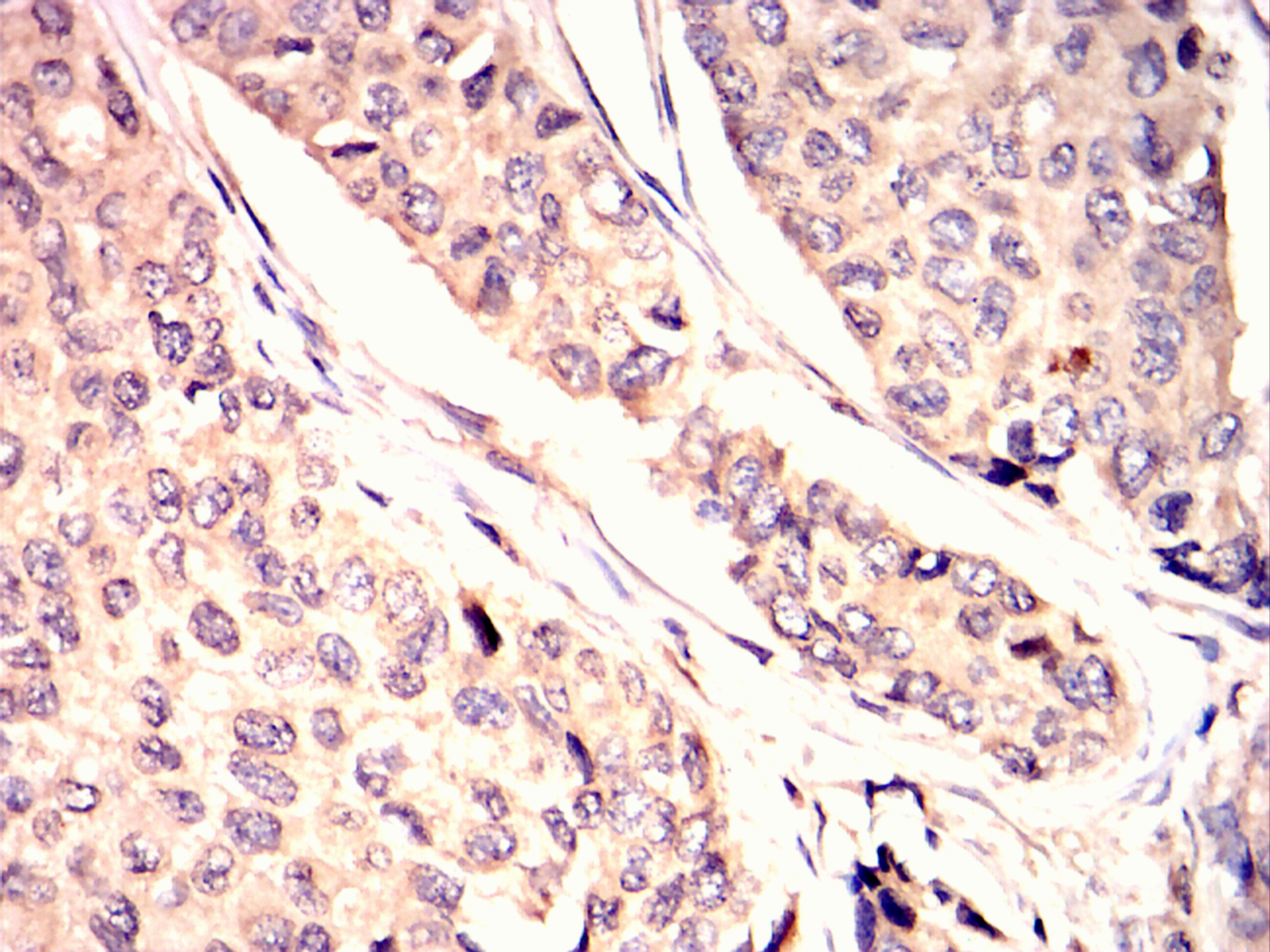 		IHC